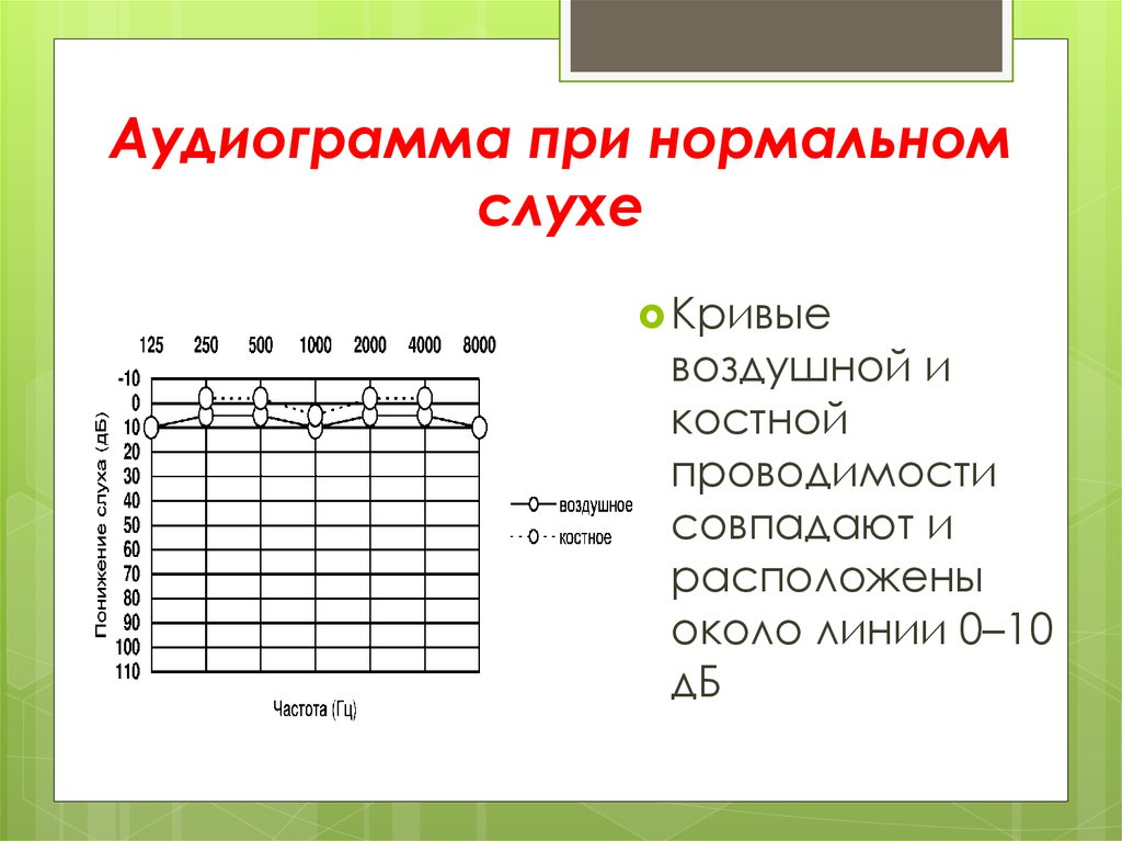 тональная пороговая аудиометрия